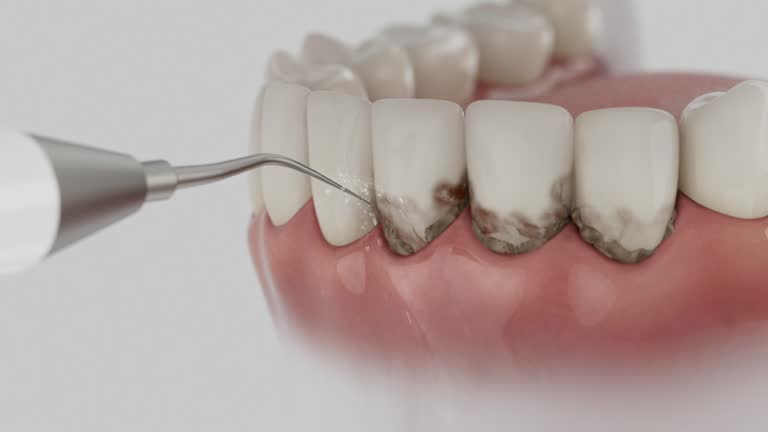 Trusted Tooth Extraction service in Newport, WA - Dentist Open Now